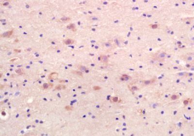 GRK6 Rabbit Polyclonal Antibody
