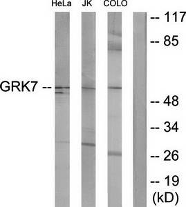 GRK7 antibody