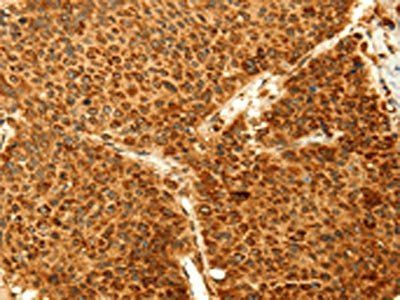 GRM3 Antibody