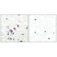 GRM3 antibody