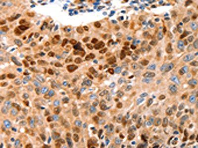 GRM4 Antibody
