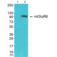 GRM6 antibody