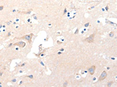 GRM8 Antibody