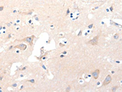 GRM8 antibody