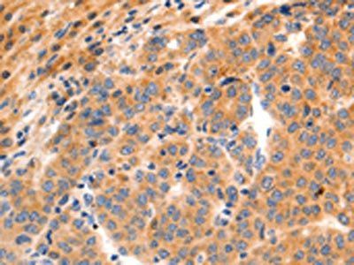 GRM8 Antibody