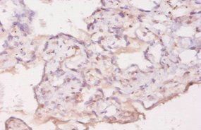 Gdf5 Antibody