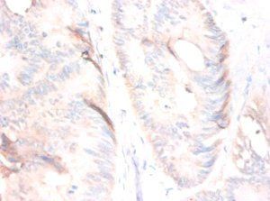 MSTN Antibody
