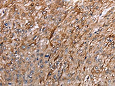 GRPR antibody