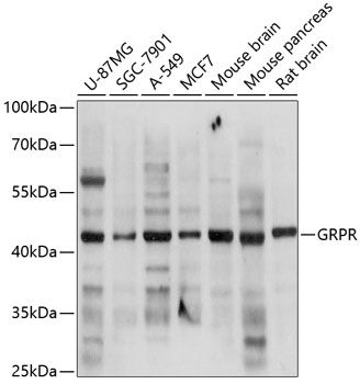 GRPR antibody