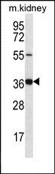 GRXCR1 antibody