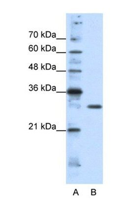 GSC2 antibody