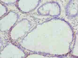 GSDMC Antibody