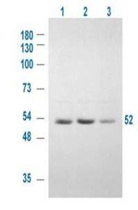 GSK3 Alpha (phospho-S21) antibody