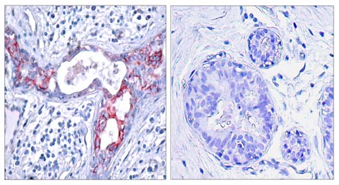 GSK3β (Phospho-Ser9) Antibody