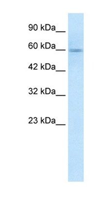 GSK3A antibody