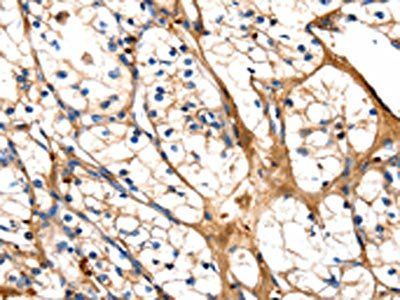 GSK3A Antibody