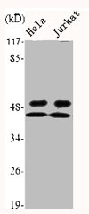 GSK3A antibody