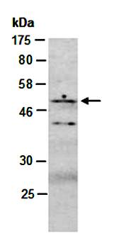 GSK3A (C2) Antibody, Rabbit Polyclonal