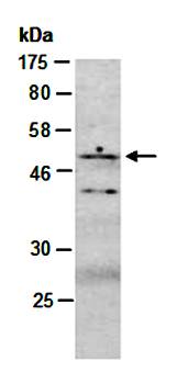 GSK3A antibody