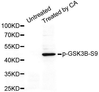 GSK3 (phospho-S9) antibody