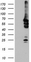 GSPT2 Antibody