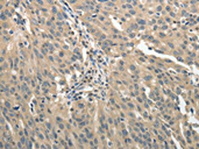GSR Antibody