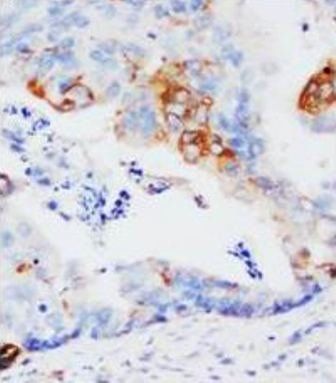 Anti-GST3/GST pi/GSTP1 Antibody