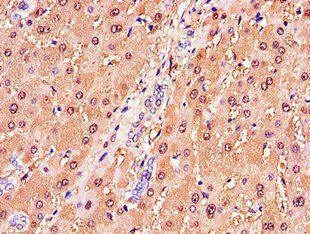 GSTA1 Antibody