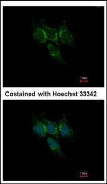 GSTA1 antibody