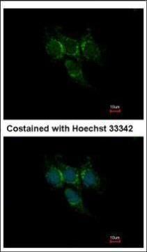 glutathione S-transferase alpha 1 Antibody