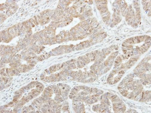 GSTA1 Rabbit Polyclonal Antibody