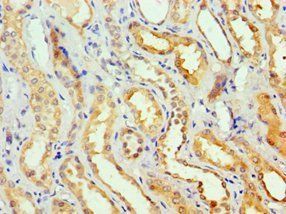 GSTA2 Antibody