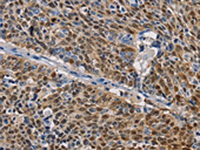 GSTA2 Antibody