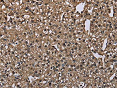 GSTA3 Antibody