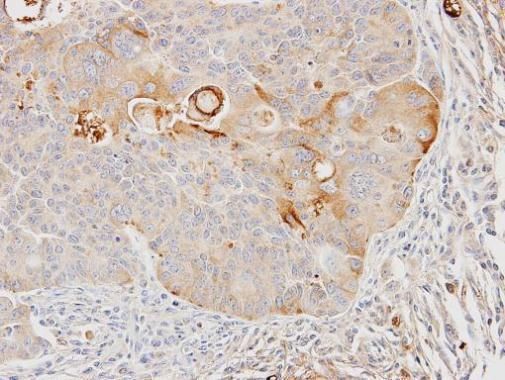 GSTA4 Rabbit Polyclonal Antibody