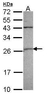 GSTA4 Rabbit Polyclonal Antibody