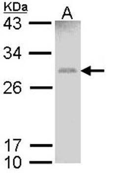 GSTM1 antibody