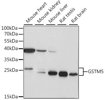 GSTM5 antibody