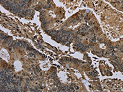 GSTO1 Antibody