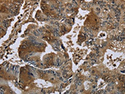 GSTO1 Antibody