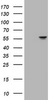 GSTO2 antibody