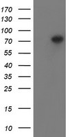 GSTO2 Antibody
