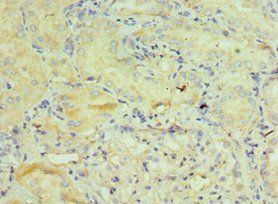 GSTO2 Antibody