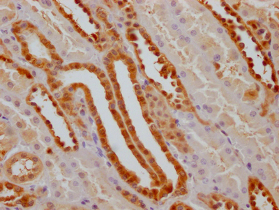 GSTP1 Recombinant Monoclonal Antibody