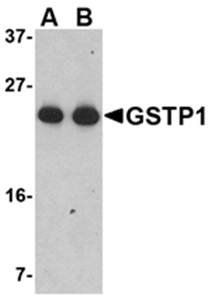 GSTP1 Antibody