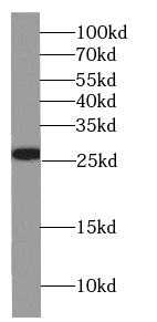 GSTT2B antibody