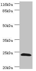 GSTZ1 Antibody