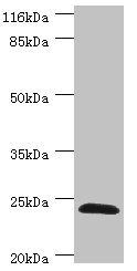 GSTZ1 antibody