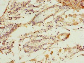 GSTZ1 Antibody