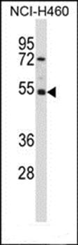 GTF2A1L antibody